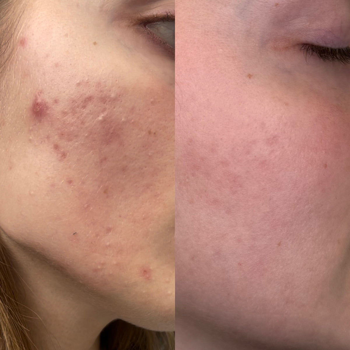 XVesuvius 30ml