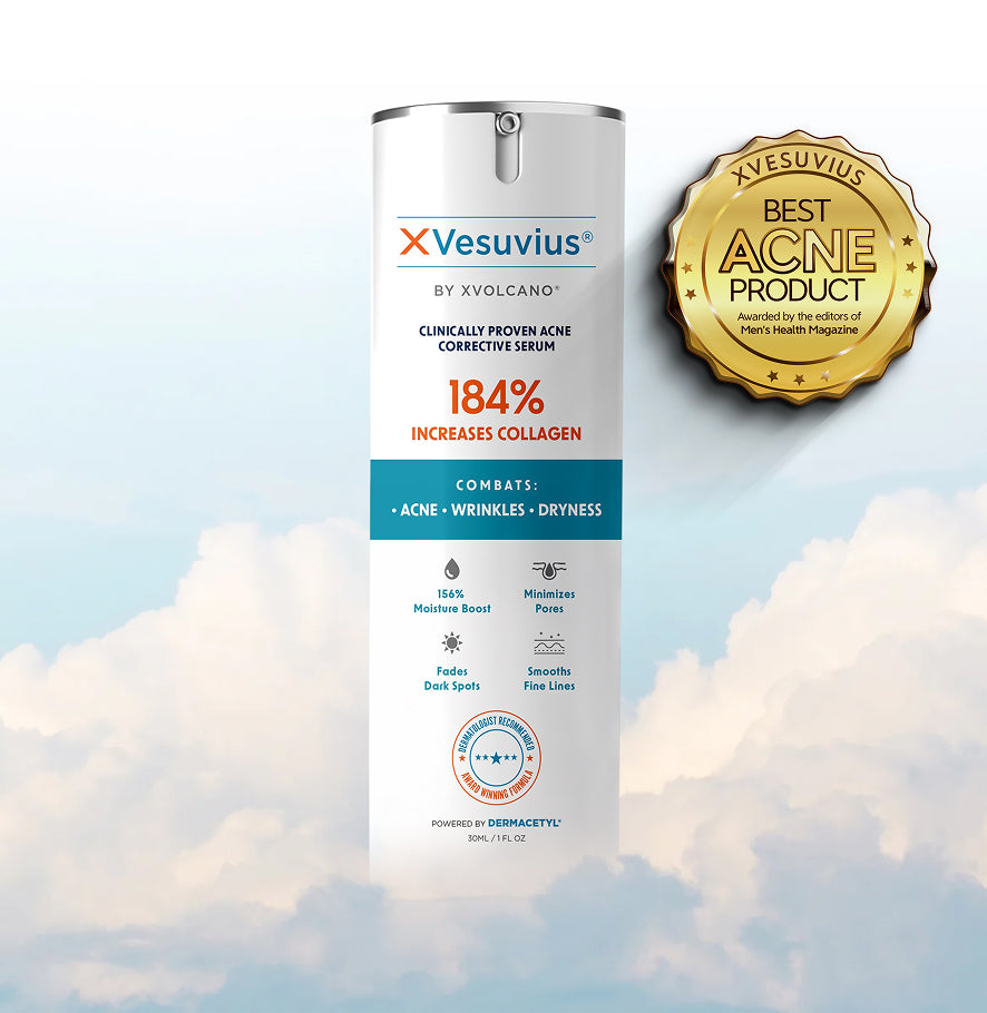 XVesuvius 30ml – XVolcano