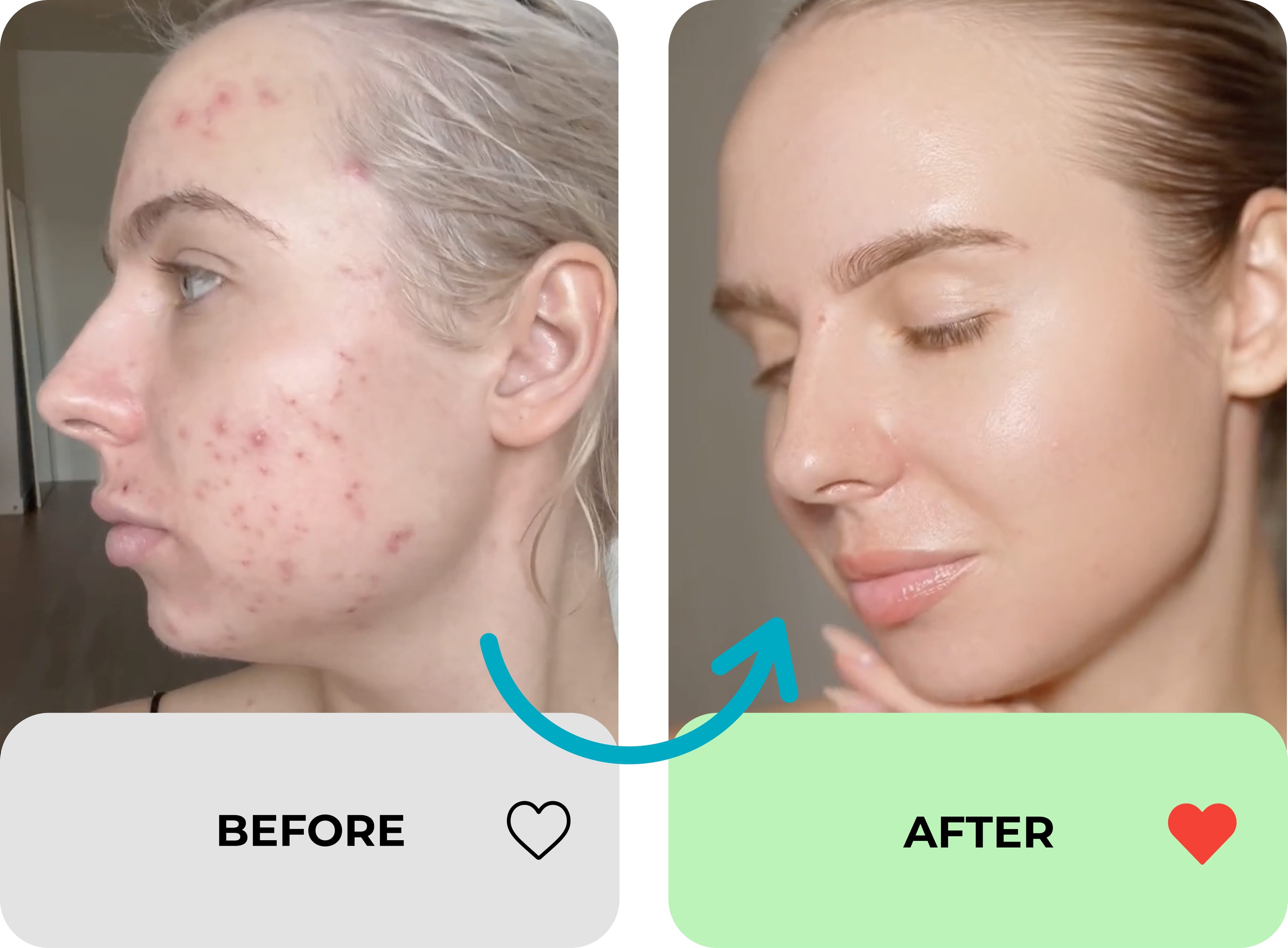 true transformation image