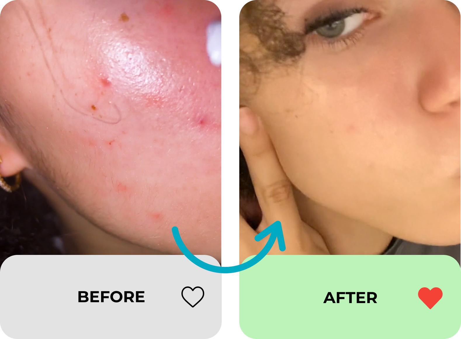 true transformation image