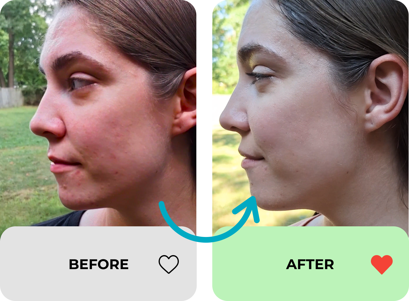 true transformation image