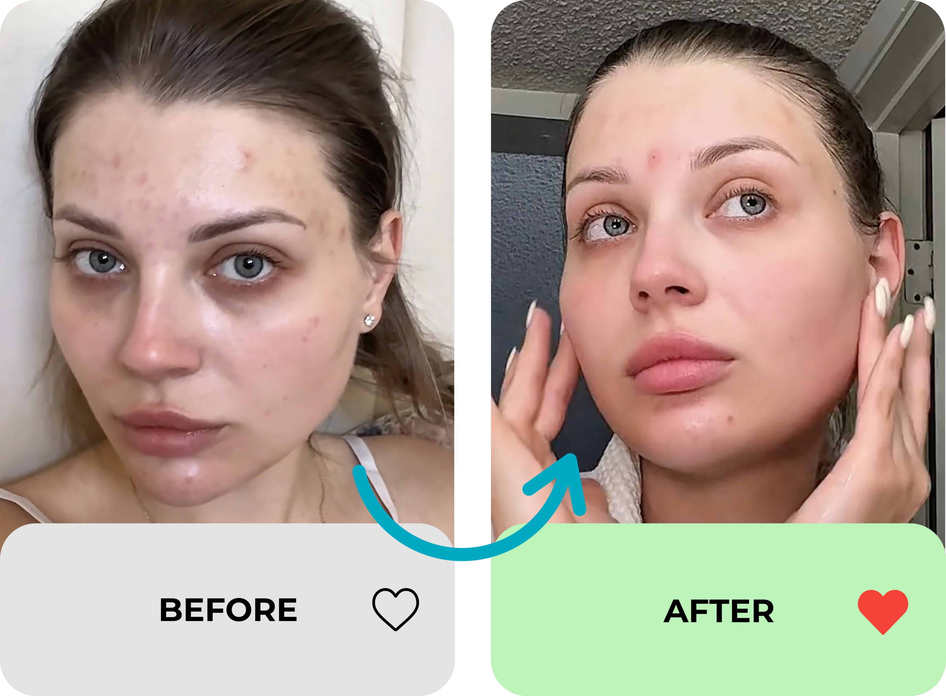 true transformation image