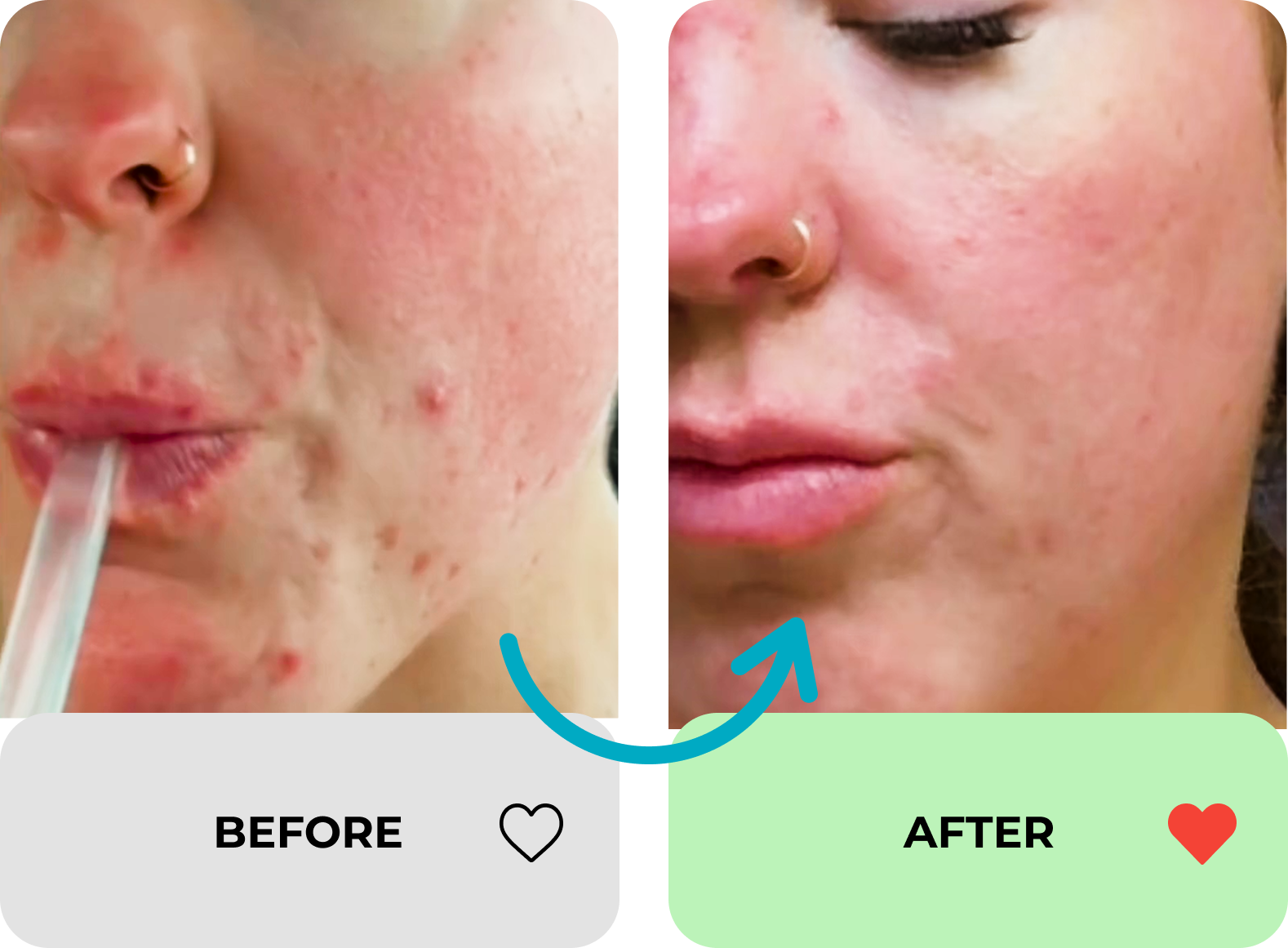 true transformation image